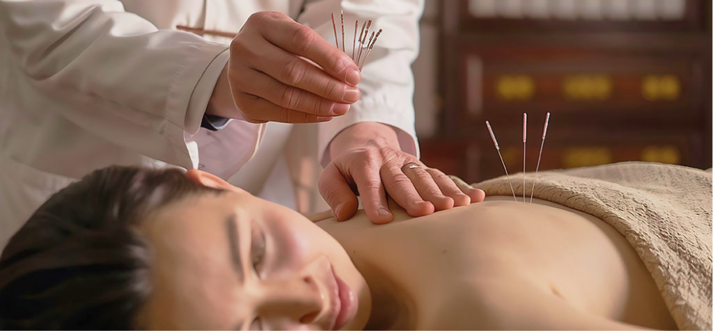 Иглоукалывание2 1.png